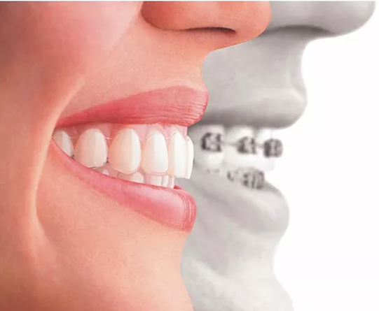 oral