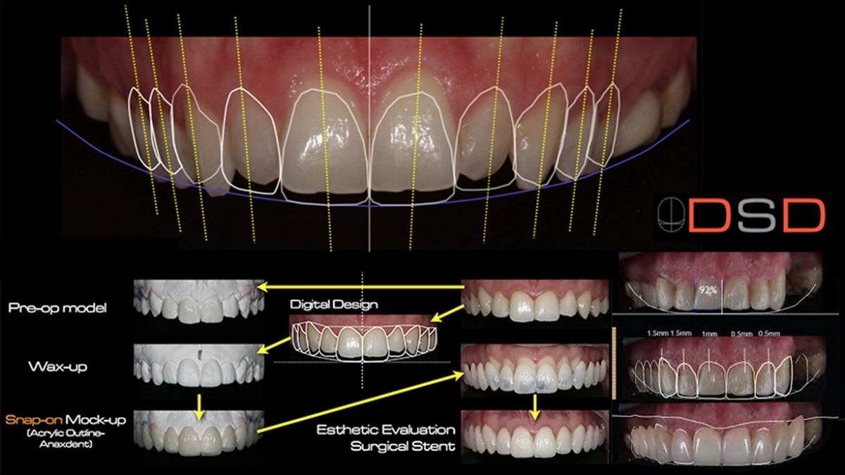 design smile