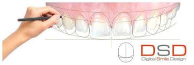 3D dentistry