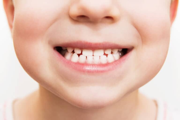 Mona Vale Dental, your trusted dental care provider