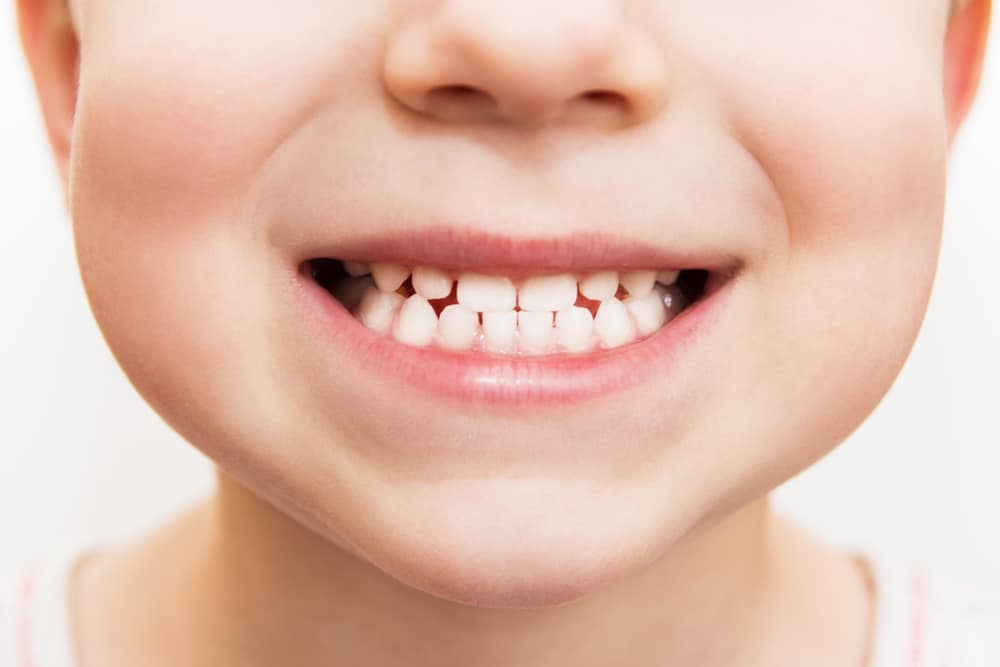 Mona Vale Dental, your trusted dental care provider