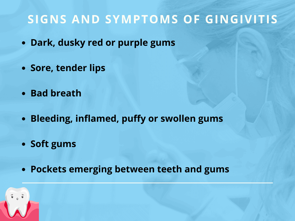signs of gingivitis