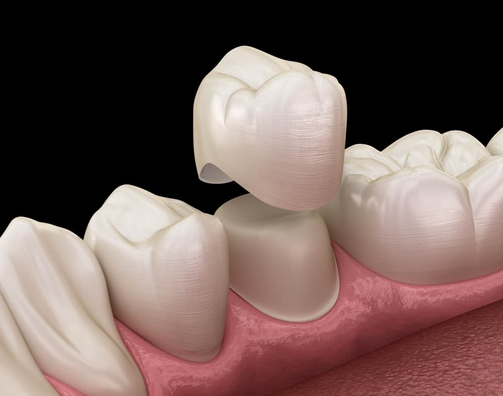 Mona Vale Dental, your trusted dental care provider