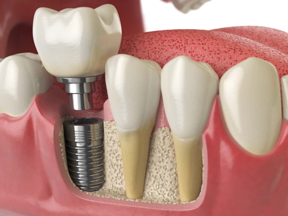 Mona Vale Dental, your trusted dental care provider