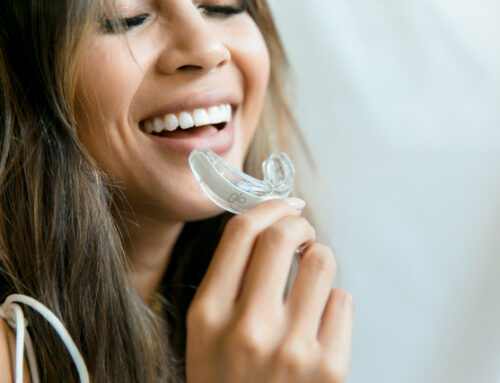 Professional teeth whitening (benefits)