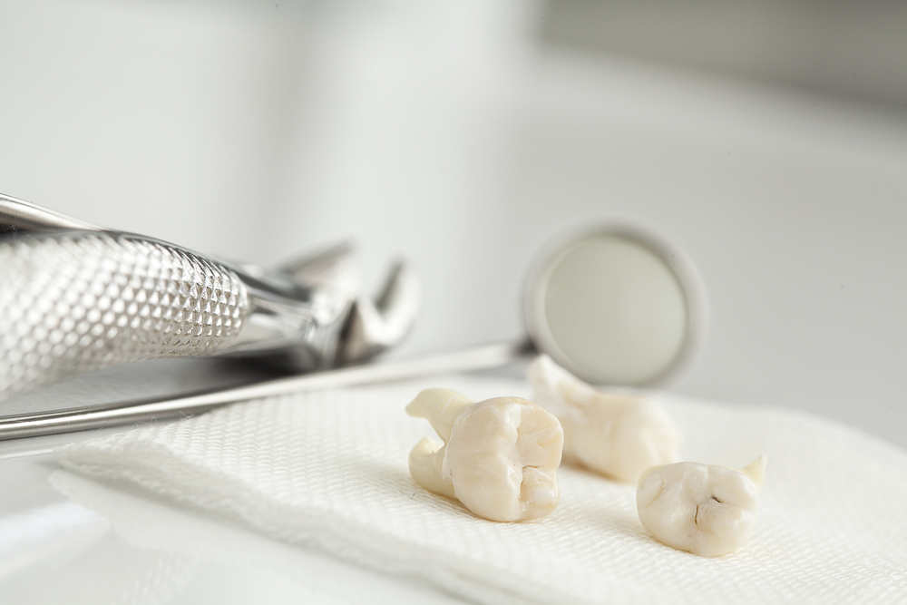 Mona Vale Dental, your trusted dental care provider