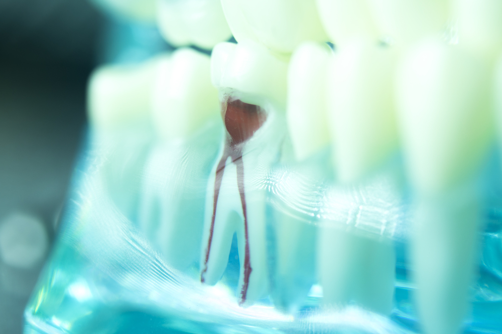 Mona Vale Dental, your trusted dental care provider