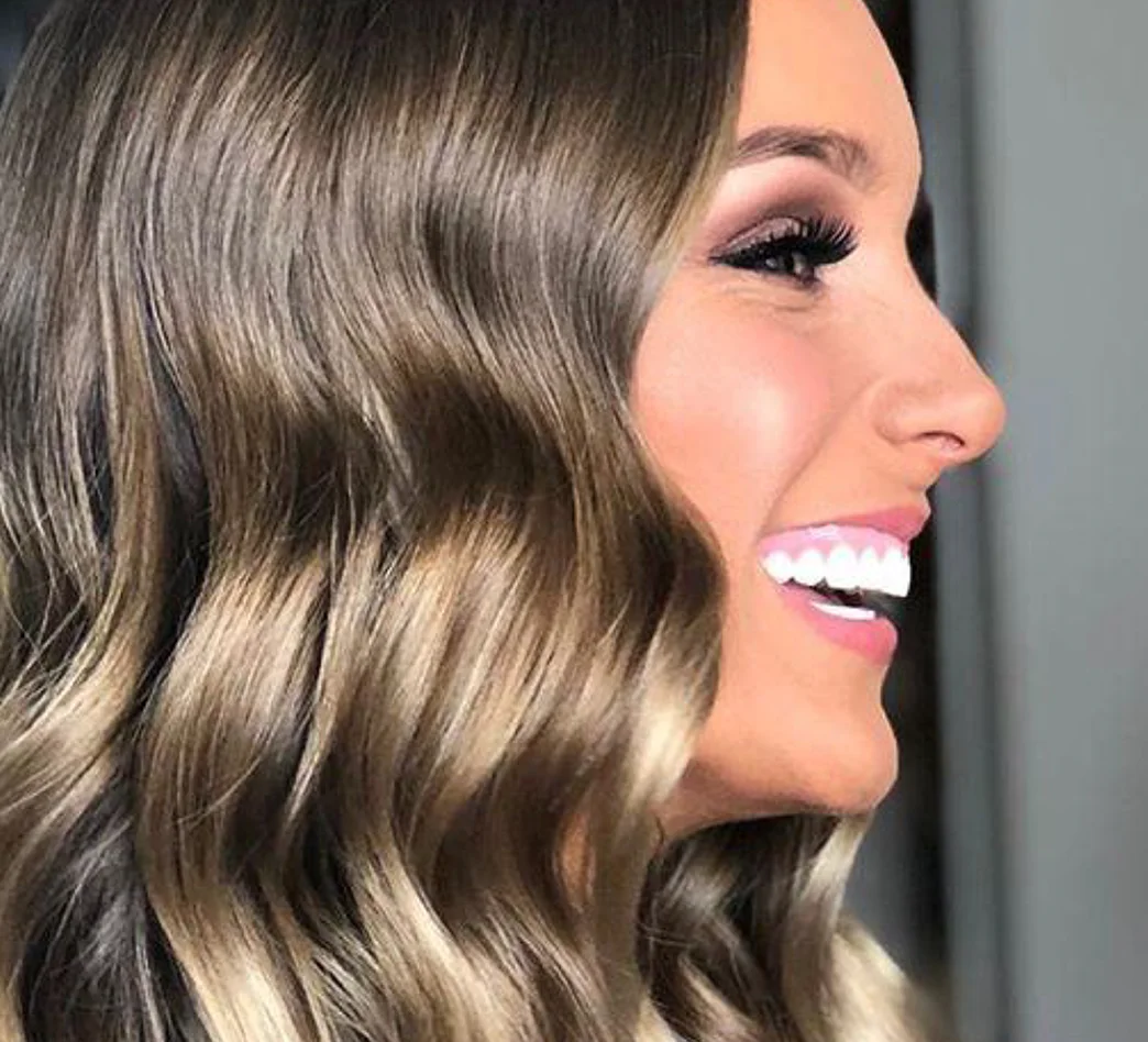 Patient smiling after teeth veneers treatment on the Northern Beaches