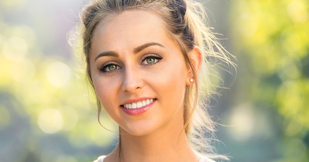 Smile Makeover Northern Beaches | Cosmetic Dentist Mona Vale